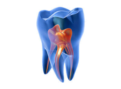 Лечение зубов седация нижний новгород