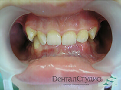 Лечение зубов под седацией в нижнем новгороде thumbnail